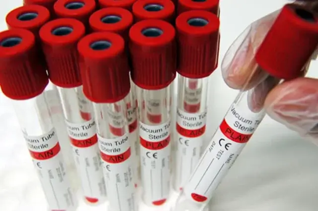 Рак выявляется по анализу крови: ученые провели исследования